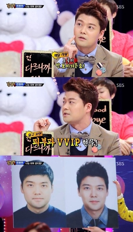 전현무, 매주 비타민C 주사… 이온관리도 받아