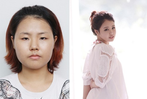 렛미인 16살에 출산한 못난이 리틀맘 김진아, 사연공개 후 시청자 격려 쏟아져