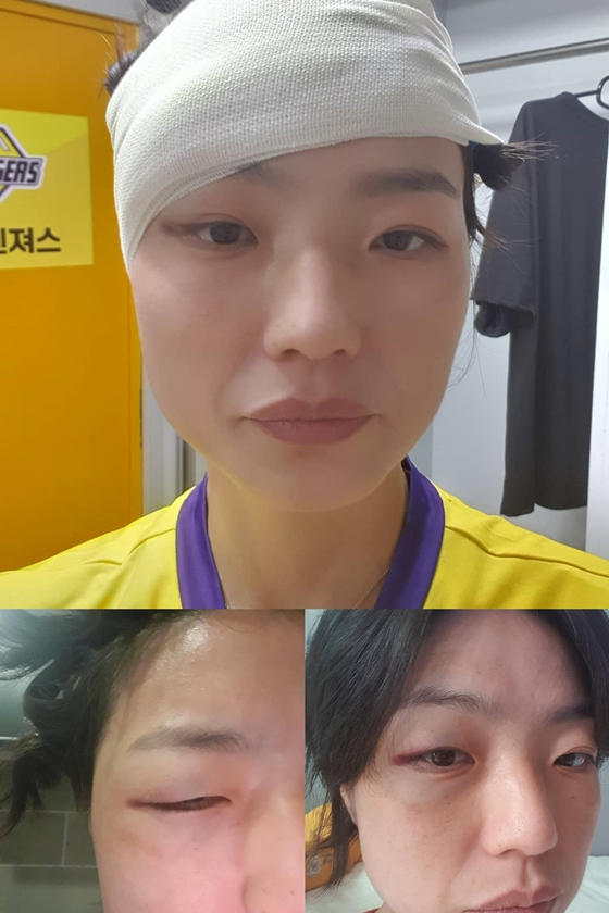 안영미, 서동주와 충돌로 피멍..골을 때리는 그녀들 [스타IN★]