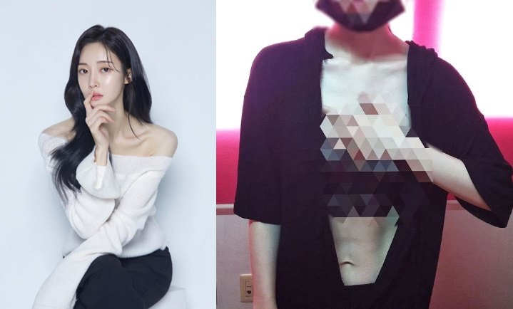 이혼 티아라 아름, 원피스 찢기고 피멍 가득 경악[전문]