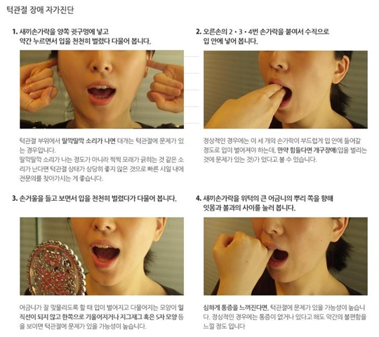 턱관절 장애 자가진단법과 해결 방법