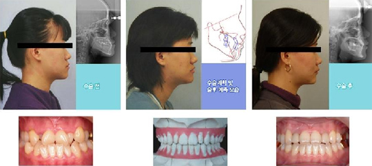 교정 전 ‘진단프로그램’으로 시술만족도 높인다