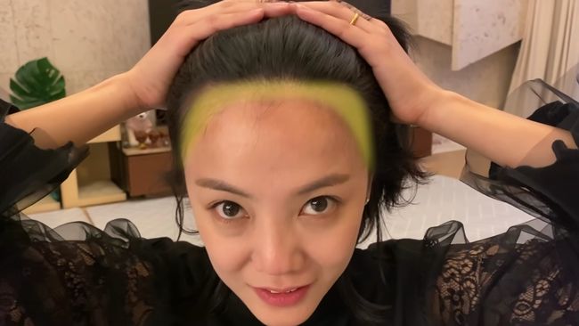 내년이 기대돼..병원 공개 NO 고은아, 모발이식 후 3개월 근황(방가네)[종합]