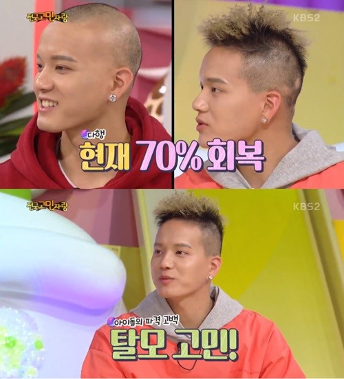 [포인트1분]‘안녕하세요’ 프니엘, 탈모 고백 그 후 “70% 회복돼”