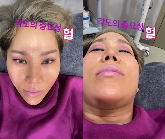 클론 강원래 아내 김송 못났다 ㅋㅋㅋㅋㅋ