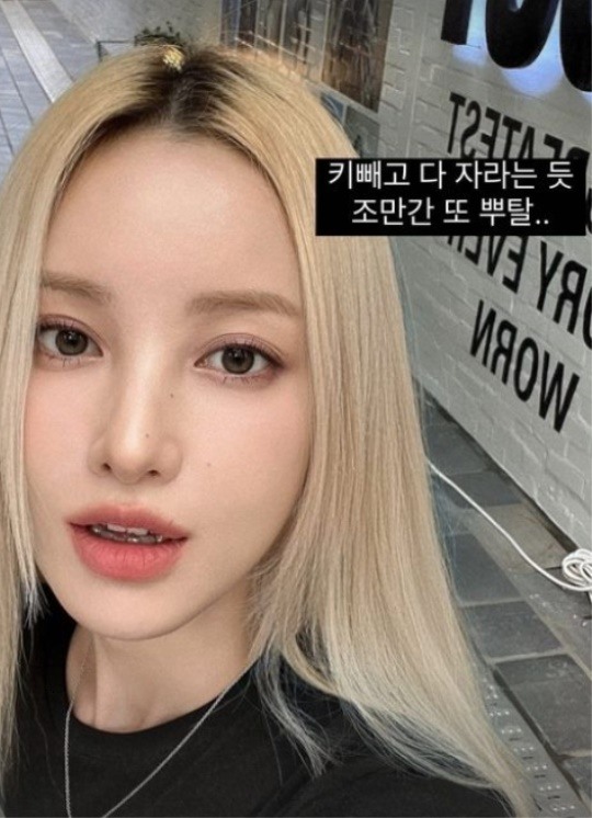 유깻잎, 윤곽 수술 후 엘프 등극..이국적인 비주얼