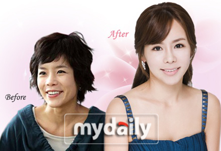 신이, 양악수술로 개성파 배우에서 청순미인으로 변신