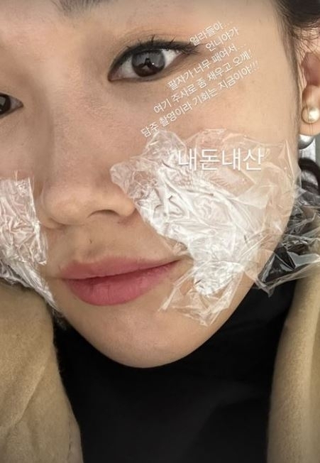 나솔 16기 영숙, 마취연고 바르고 성형시술 인증 언니야가 팔자가 패여서…
