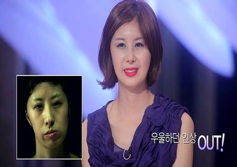 렛미인 유진, 얼굴뼈 녹는 여자→연예인급 미녀로 감동