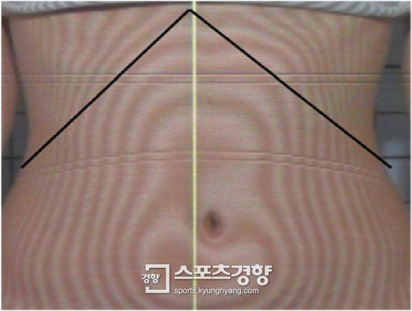 [깨소금] ‘정병훈의 신(新)동의보감’ 살과의 전쟁, 알아야 승리한다②