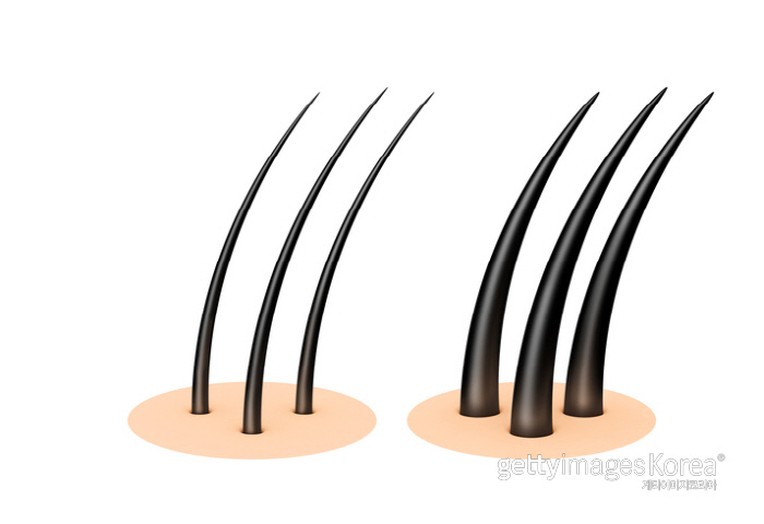 탈모 치료 ‘청신호’…국내 연구진, 모발 생성 세포 대량 배양 성공