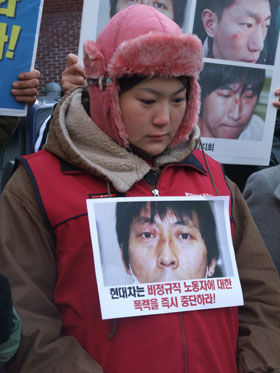 “현대차 구사대와 용역, 이제 그만 좀 때리자”