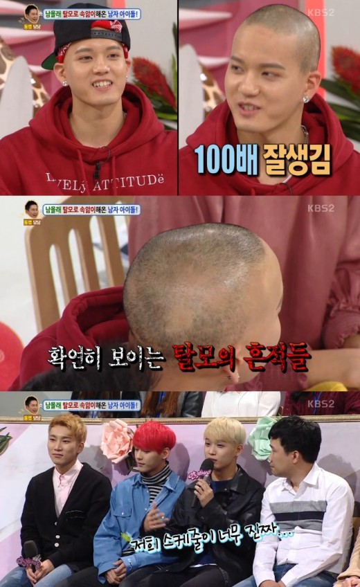안녕 비투비 프니엘 현직 아이돌 탈모고백이라니![종합]