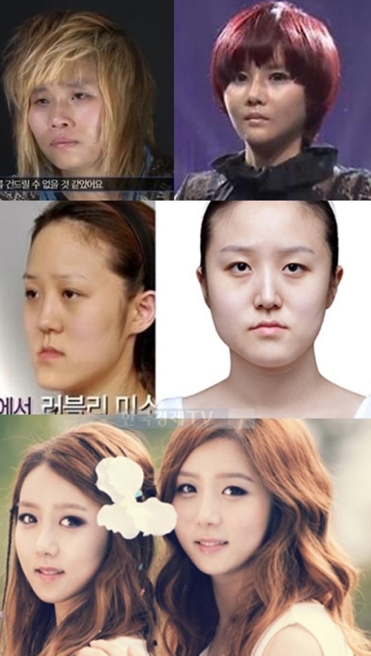 렛미인4 첫 주인공, 야수 외모에서 걸그룹 미모로…울상 자매보다 놀라워!
