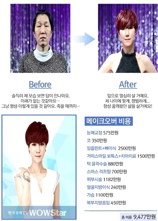 렛미인4 20대 할머니 문선영, 최고반전녀 등극? 성형 비용 세세히 보니..