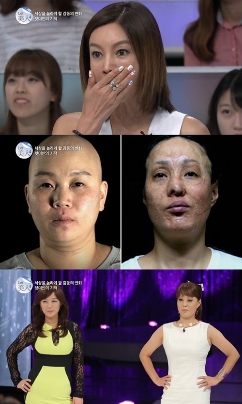 ‘렛미인’ 괴물 엄마-털없는 엄마의 놀라운 대변신 ‘누가 봐도 아름다운 그녀들’