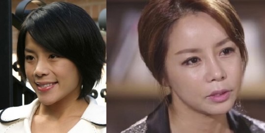 신이, 양악수술 후 3년간 일 끊겼다 과거에는 어땠길래?