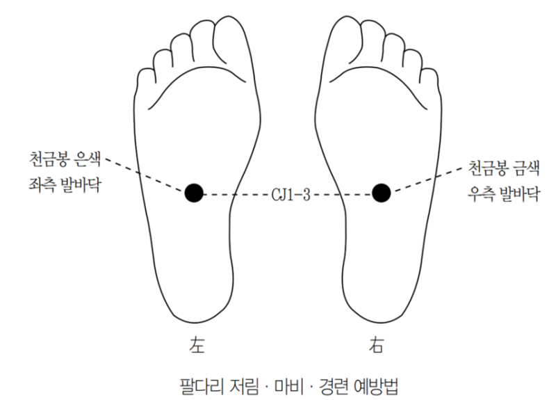 고려수지침학회가 전하는 저림·마비·경련 예방법