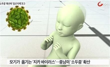 “지카바이러스 감염 아기, 머리 둘레 정상이어도 뇌 손상 가능성 높아”