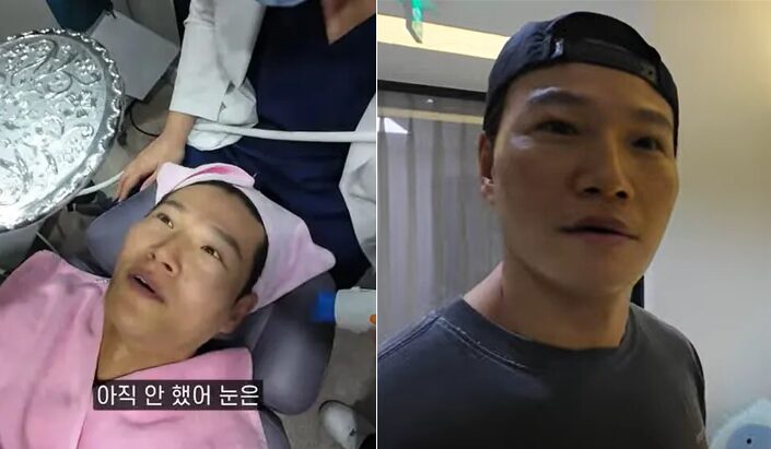 김종국 “어려보여, 눈도 커졌다?”…생애 첫 레이저시술, 뭐 했나?