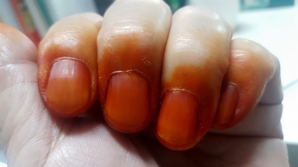 [풀각시의 소풍] 고운 손이 부끄러워서...