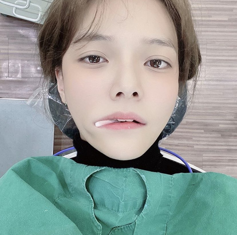 그래도 사랑해…AOA 지민, 과자 먹다 치과 간 이유는? [★해시태그]