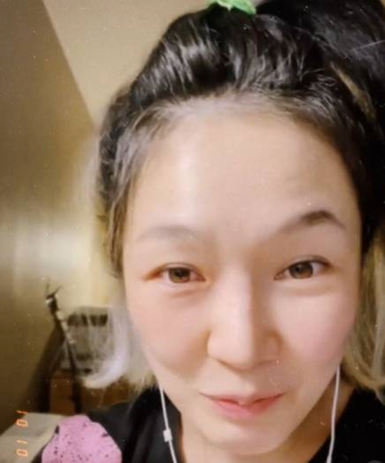 자두 하다 하다 이젠 머리까지…새벽에 놀라