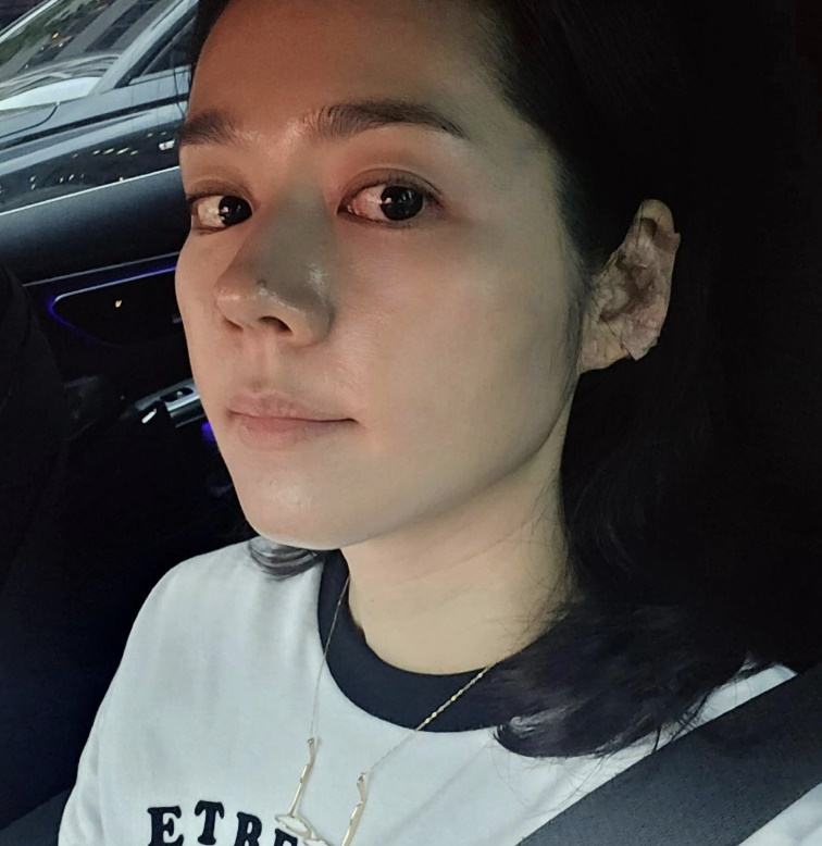 연정훈♥ 한가인 컨디션 너무 안 좋아 결국 이 요법까지…걱정 쇄도