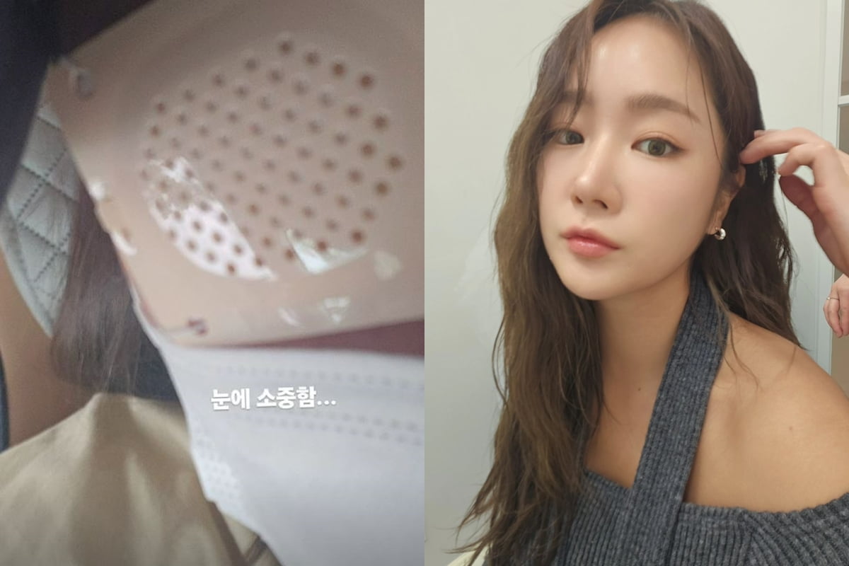 씨스타 소유, 눈 부상 당했다…순간 안 보여