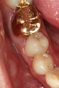 2016072200914_0_99_20160722111804.jpg?ty