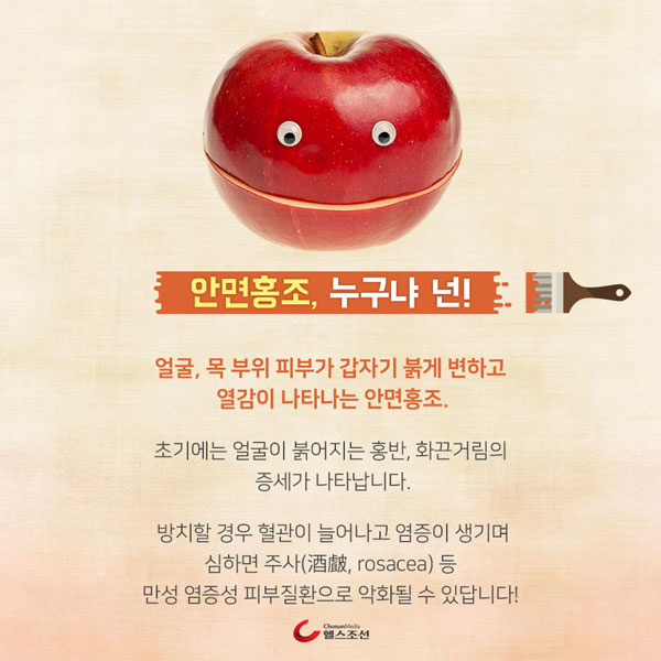 [카드뉴스] 안면홍조, 쉽게 보고 방치하면 큰일 나요!