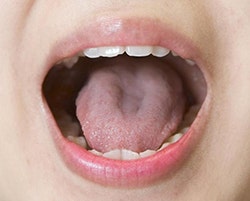 0000018593_001_20171210080151252.jpg?typ