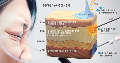건조하니 주름 자글자글… 피부 보호막 이것 필수