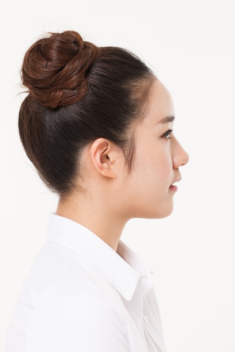똥머리 예쁘죠, 탈모 생길 수 있죠