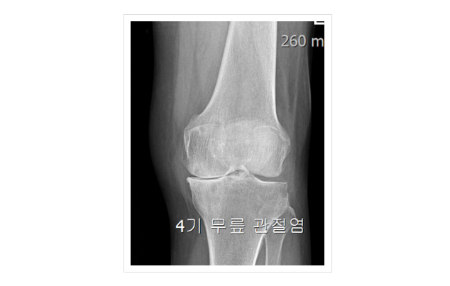 잘 걷는게 이렇게 행복한 일인지 몰랐어요 [ 만성통증을 해결은 척추와 골반의 정렬 해결이 먼저입니다.]