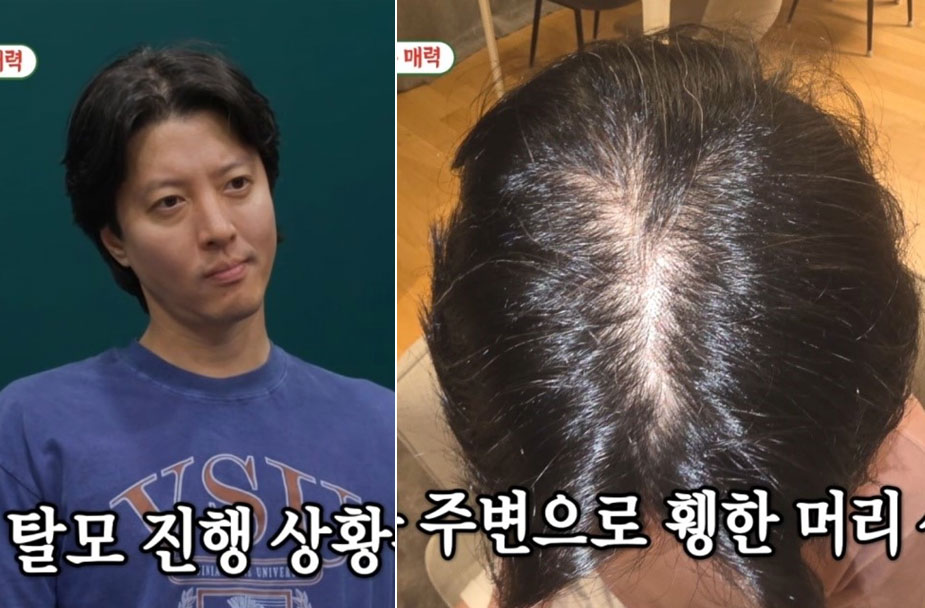 이동건, 탈모 탓 머리에 이것 사용… 두피 문신 추천 받기도