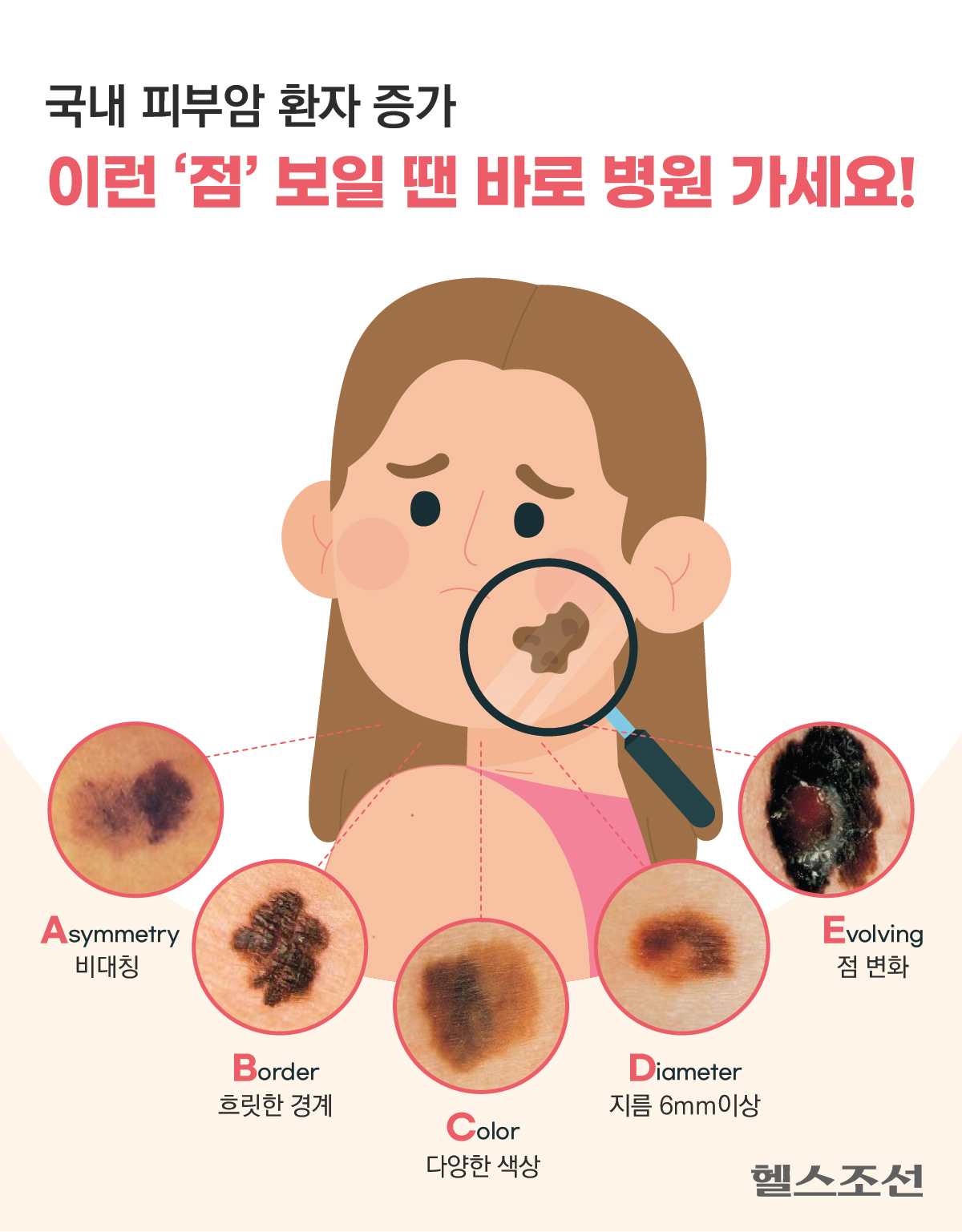 20년간 국내 ‘피부암’ 환자 7배 증가… 자외선이 주 원인 아니다?
