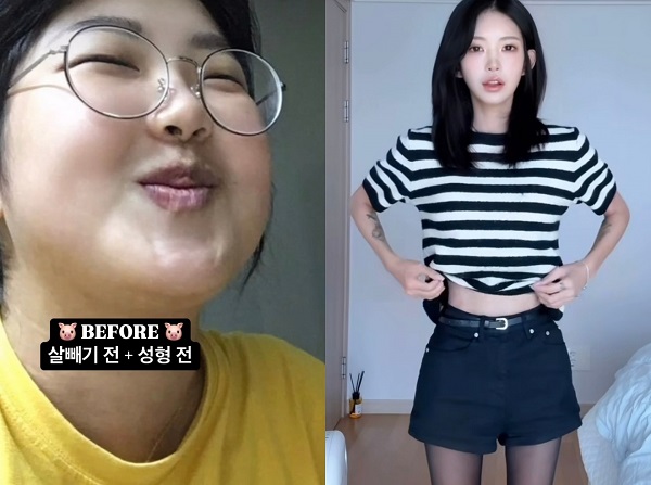 “다이어트 성공, 55kg 감량” 최준희, 충격 전후 사진… 관리 위해 챙겨 먹은 ‘음식’은?
