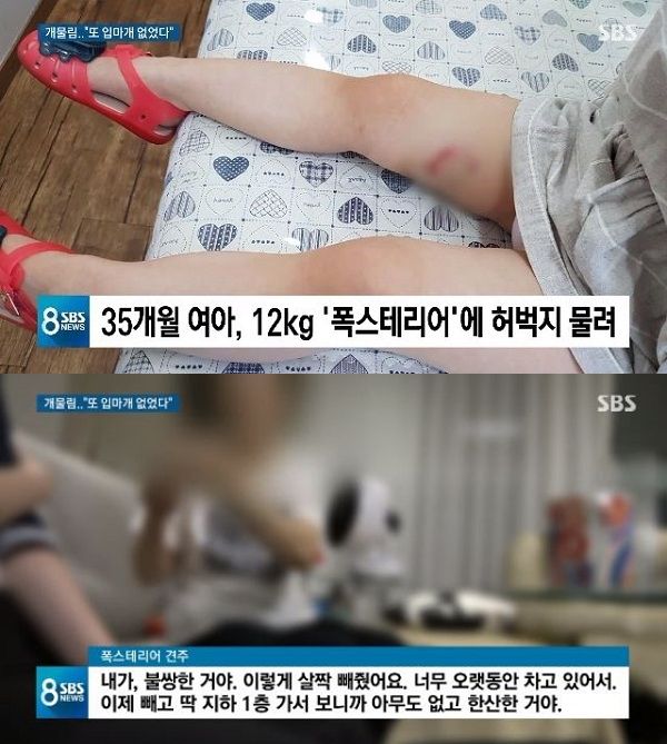 강형욱 분노 “폭스테리어는 난폭…안락사 시켜야”←3세 여아 물고 끌고가