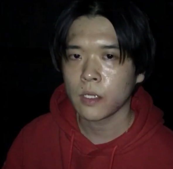 [전문] 래퍼 비프리, 킹치메인 폭행했다가 입건…쌍방 인증