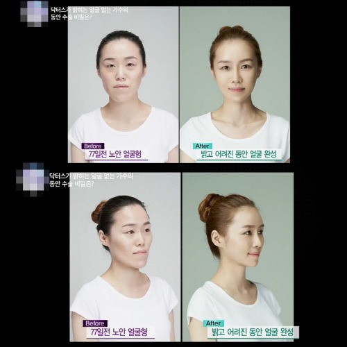 렛미인3 얼굴없는 가수 한설희 화제, 이제는 무대 위 디바로 화려하게 변신