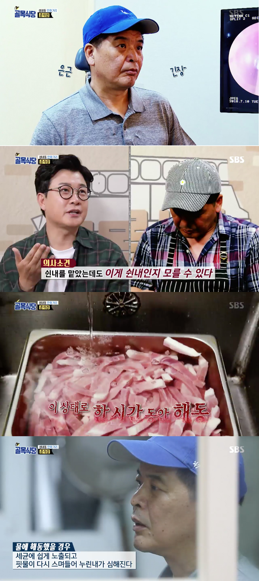 골목식당 중식집 사장님 후각 검사…쉰내 맡아도 쉰내인지 모를 수 있어 의사 소견