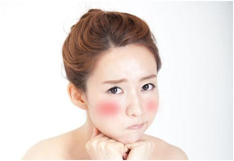 겨울철 심해지는 안면홍조, 천연 보습제로 관리