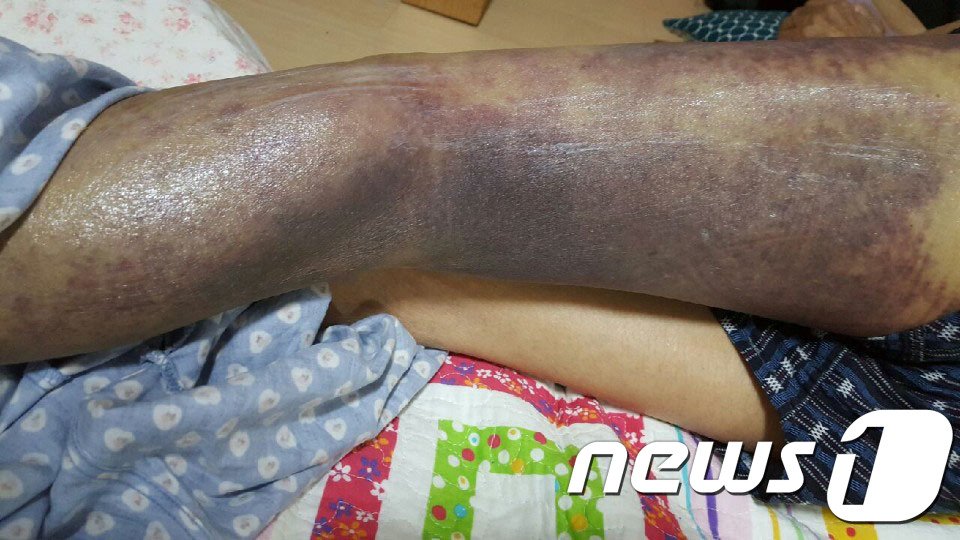 광주시립요양병원 폭행의혹 진상규명…책임자 처벌