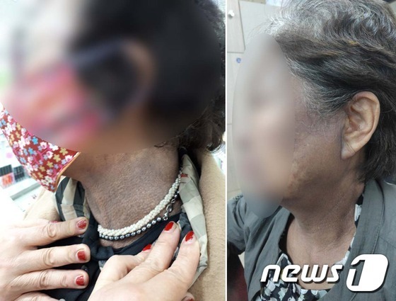 천연 헤나염색 왜 부작용? 화학약품 섞거나 가짜 사용