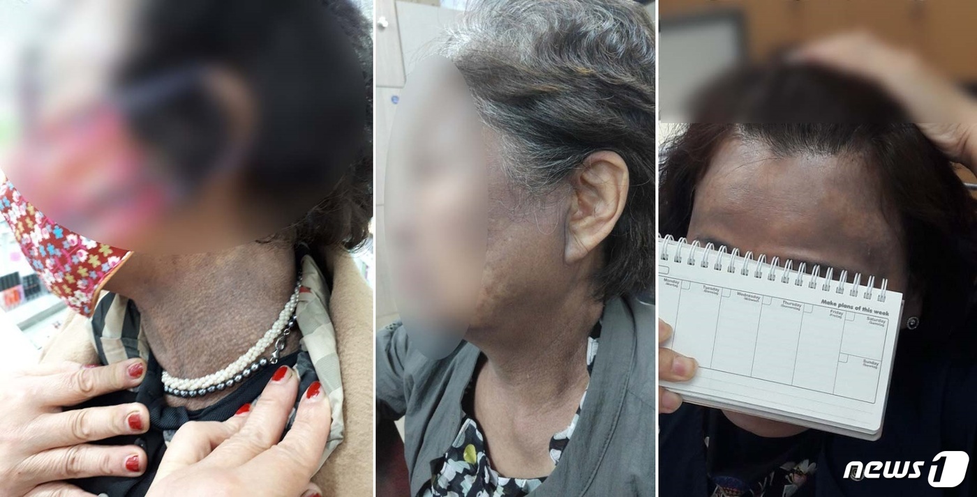 헤나염색 부작용 원인 찾아라…식약처 자체분석 나서