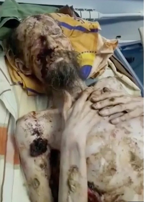 곰에 납치된 미라상태 남성 한달만에 구조