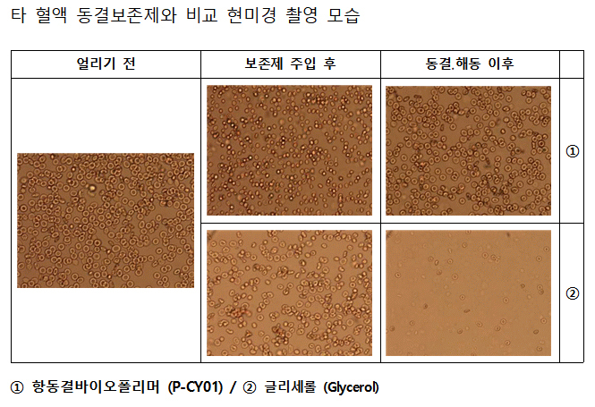 남극 해양미생물로 혈액 장기보관 성공…냉동인간 기술 시대 오나