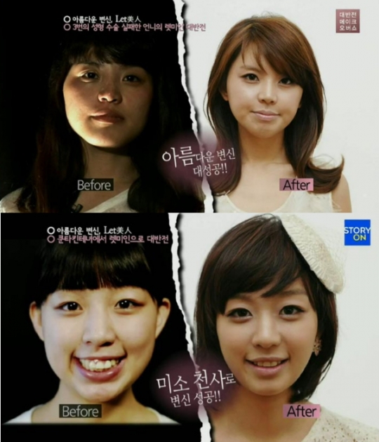 은둔녀·쿤타킨테녀, 성형으로 인생 역전?… 미녀 변신 놀라워