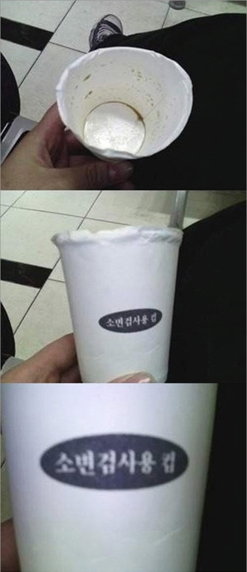 간호사 누나가 준 커피, 설마 저 컵이… 충격